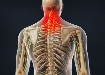 Cervical Neck/Back Pain