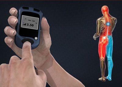 Spinal Cord Stimulator Implant